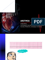 Aritmia