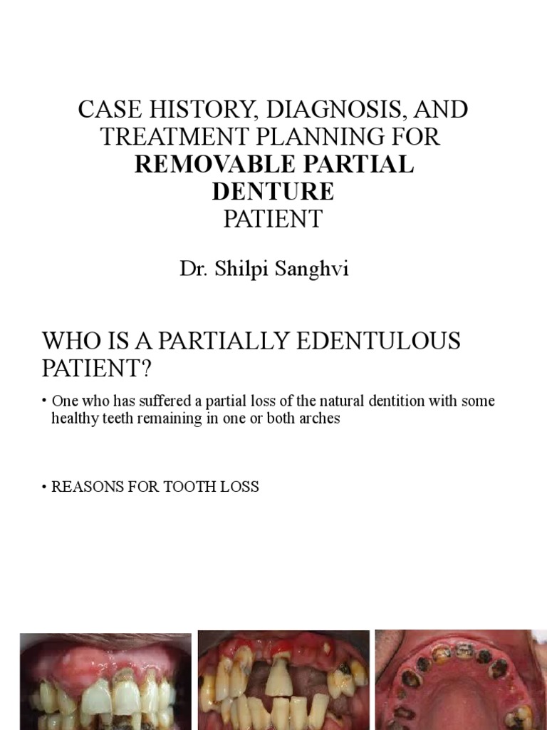 Case History, Diagnosis and Treatment Planning For Removable Partial