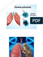 Exposicion de Biologia ENFISEMA PULMONAR