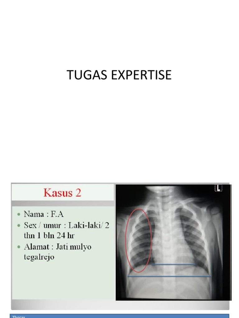 Hasil Rontgen Thorax dan Clavicula | PDF