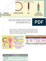 Anticoncepcion Hormonal