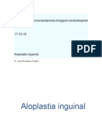 Aloplastia Inguinal