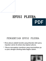 Efusi Pleura