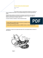 Evaluacion Del Paciente Con Mareos de Comienzo Agudo PDF
