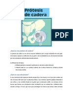 02 Manual para El Paciente - Protesis de Cadera