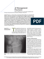 Scaophoid Fractures PDF