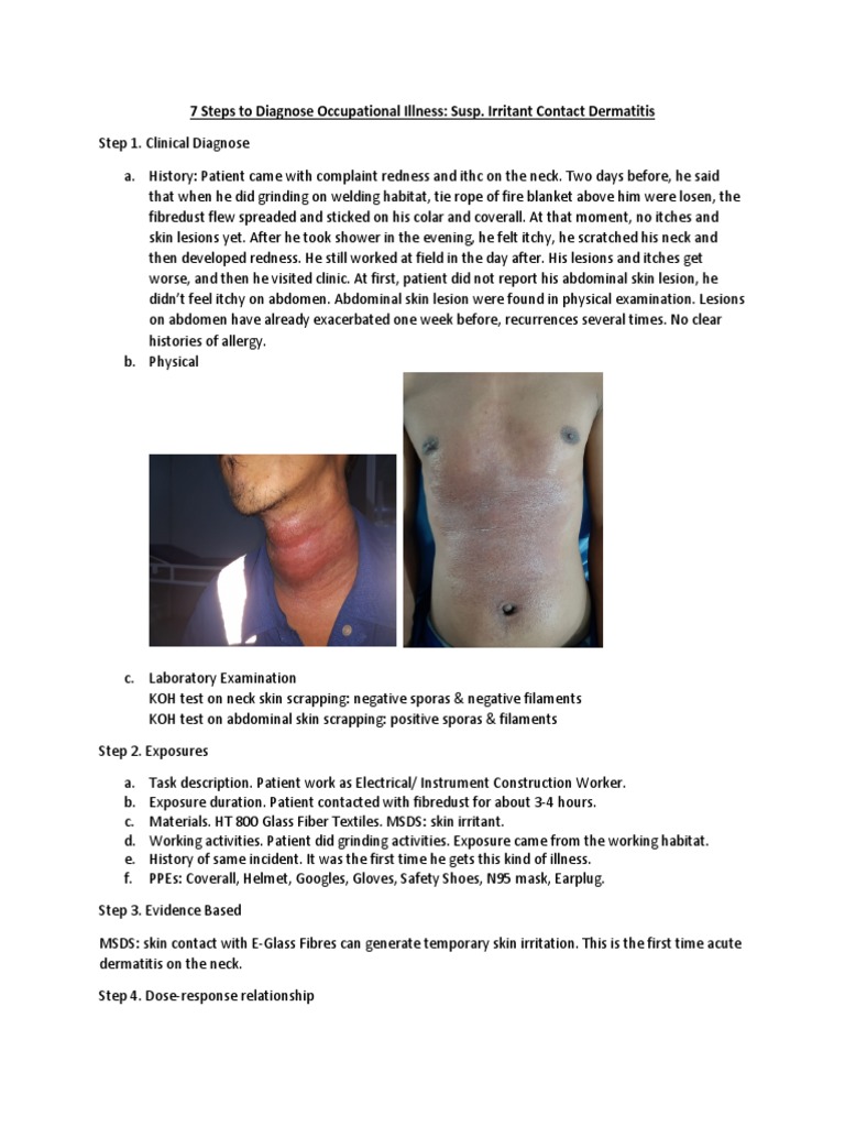 7 Steps To Diagnose Occupational Illness Susp. ICD PDF Dermatitis
