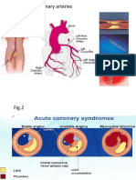 Classification of Angina Severity and Diagnosis of Ischemic Cardiopathy