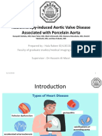 Radiotherapy-Induced Aortic Valve Disease Associated With Porcelain Aorta