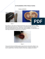 Post Mortem Examination Renal System