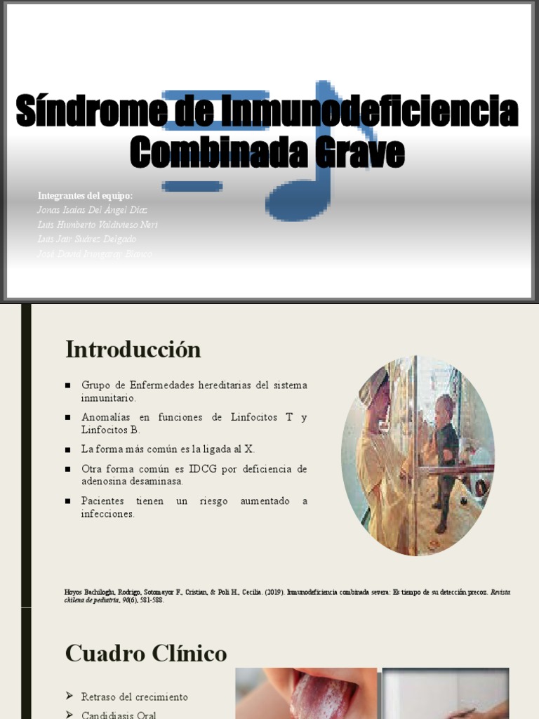 Síndrome de Inmunodeficiencia Combinada Grave PDF Inmunología