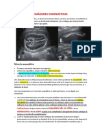 Imágenes Diagnosticas: Músculo Esquelético