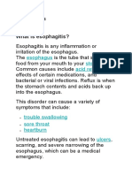 Esophagitis: Esophagus Stomach Acid Reflux