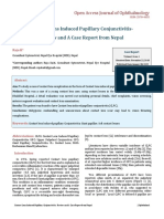 Contact Lens Induced Papillary Conjunctivitis Review and A Case Report from Nepal