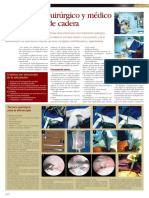 artrosis_cadera 2.pdf