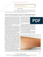 Immune Thrombocytopenic Purpura in A Patient With Covid-19: Correspondence