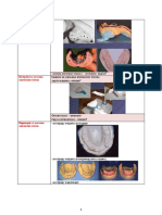 Parcijalna PDF