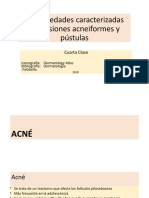 IV Clase Acneiformes y pústulas