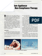 The Pendulum Appliance For Class II Non-Compliance Therapy: Rthodontists