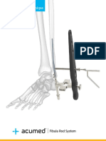 Surgical Technique: Fibula Rod System