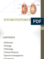 urology4hydronephrosis-160730025731.pdf