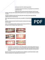 Klasifikasi Diskolorisasi Fluorosis