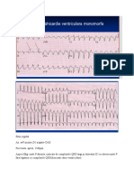 EKG