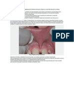 Caso Clínico1 PDF