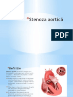 Stenoza Aortică