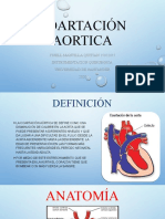 Coartación Aortica: Yisell Mantilla Quitian 15022017 Instrumentacion Quirurgica Universidad de Santander 2020