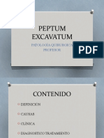 Peptum Excavatum