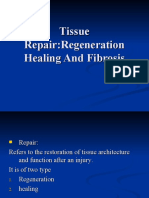 Tissue Repair:Regeneration Healing and Fibrosis