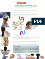 Torticolis PDF