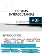 Fistulas Enterocutaneas