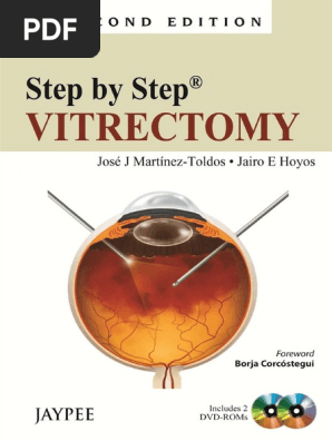 Step By Step Vitrectomy Pdf Vision Medicine