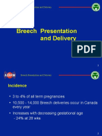 Breech Presentation and Delivery Alarm