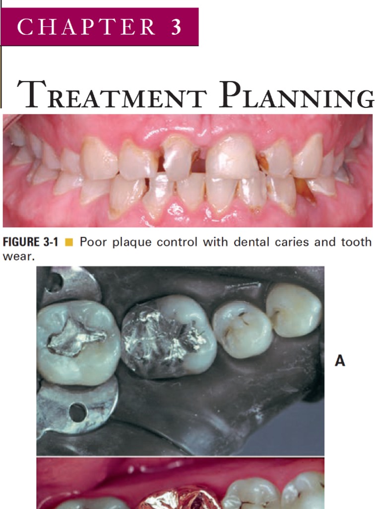 Conservative Dentistry PDF PDF