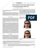 Bilateral Dimples That Are Rarely Seen in The Lower Alignment of The Mouth Corners Fovea Inferior Anguli Oris PDF