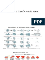 Anemia e Insuficiencia Renal