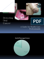 Detecting Oral Cancer: A Guide For Health Care Professionals