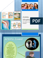 Presentación de Artritis