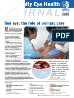 Red Eye The Role of Primary Care