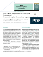 Using A Mutaf Triangular Flap'' For Lower Eyelid Reconstruction