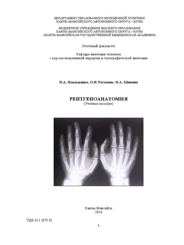 Рентгенанатомия Садофьева | PDF
