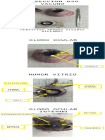 Diseccion Ojo Vacuno