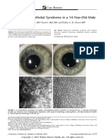 Iridocorneal Endothelial Syndrome in A 14-Year-Old Male