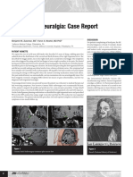 Trigeminal Neuralgia_ Case Report and Review.pdf