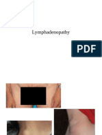 Lymphadenitis 2020 PDF