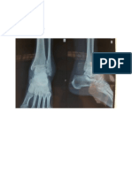 Status Lokalis Ankle Rom Ankle Resisted Isometric Testing Radiologi Ankle