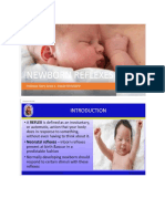 4-1-NEWBORN-REFLEXES